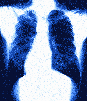 lungs